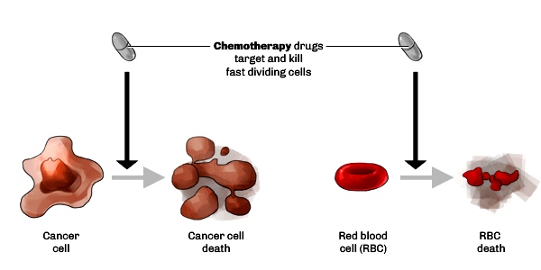 treatment_chemotherapy